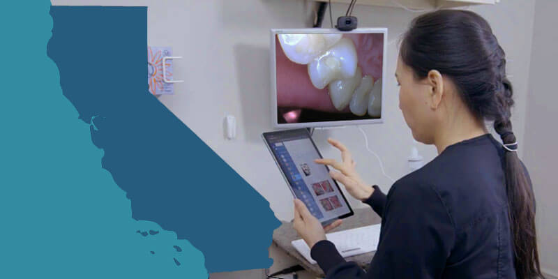California: A Leader in Teledentistry Acceptance