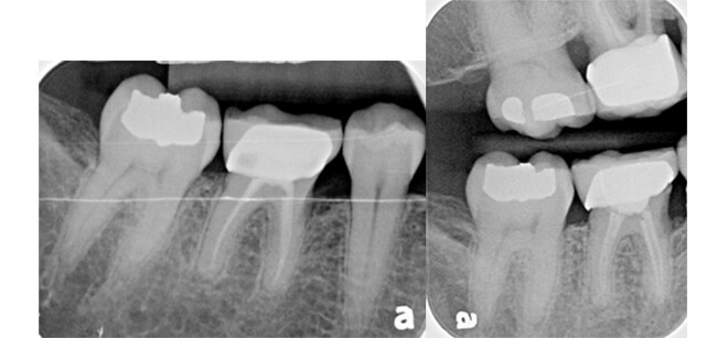 Sample x-ray