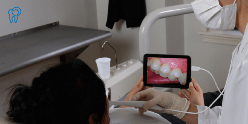 The Importance of Intraoral Cameras in Oral Cancer Screening