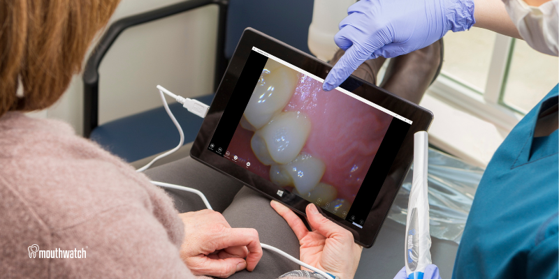 Elevate Your Dental Practice with Intraoral Imaging