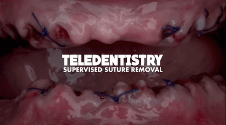 Successfully Coordinating Complex Dental Cases with Teledentistry
