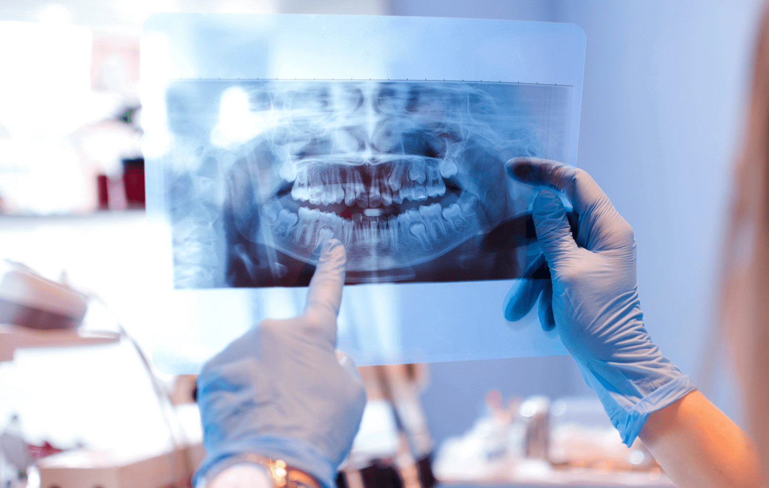 Image of dentist reviewing an xray