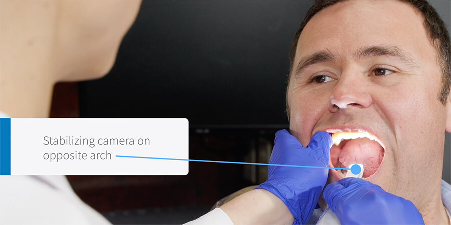 Grasp and Imaging Techniques for Intraoral Cameras