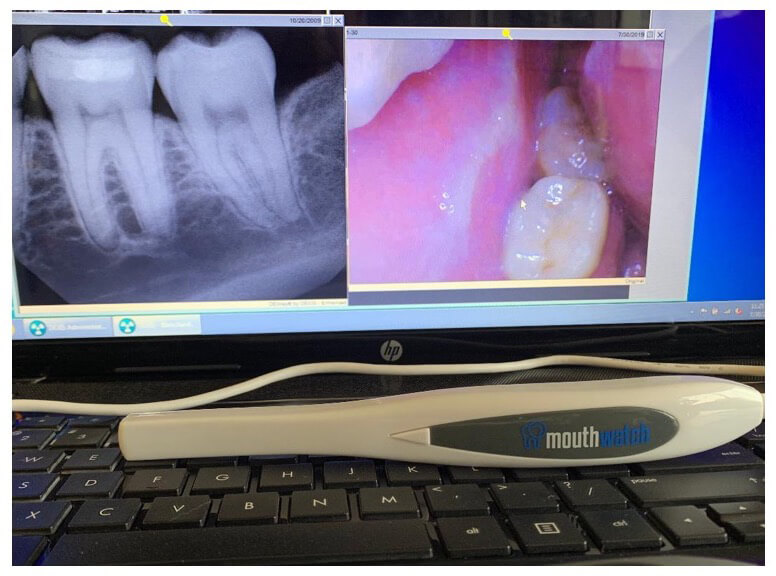 Using camera with xray side-by-side